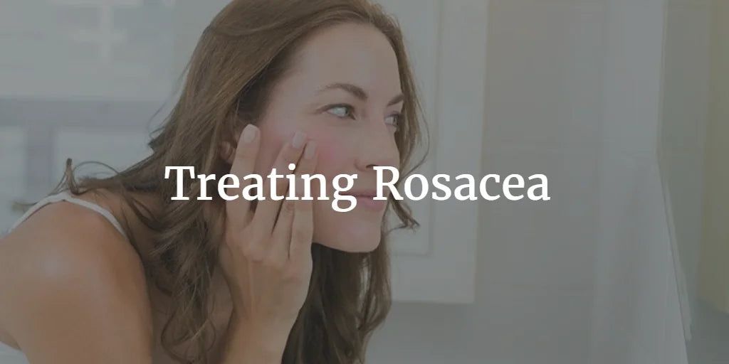 NATURALLY TREAT ROSACEA