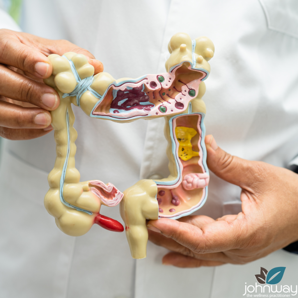 Digestive Health: Managing IBS Naturally