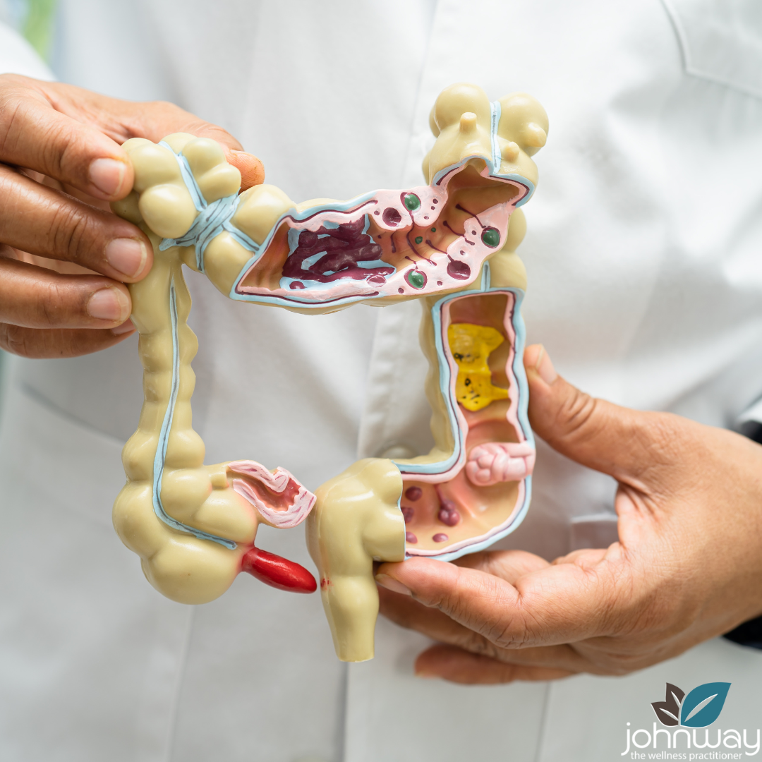 Digestive Health: Managing IBS Naturally